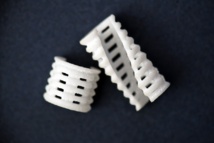 3D-Printed Airway Splints Cure Deadly Trachealbroncomalacia