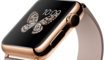 Want To Make A Call? Just Hold Up Your ‘Smart’ Wrist Watch