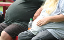 Obesity in the US: the Problem Is Growing Bigger